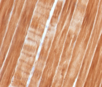 ACTN2 Antibody / Sarcomeric Alpha Actinin / Alpha Actinin 2