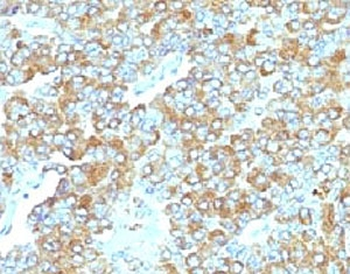TIM-3 Antibody / HAVCR2