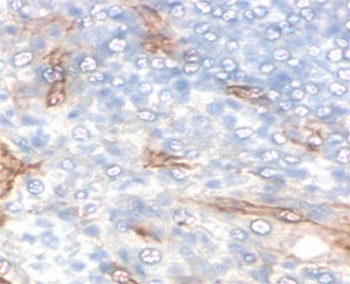 TIM-3 Antibody / HAVCR2