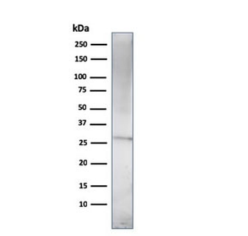 Prolactin Antibody / PRL