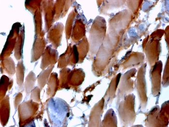 ACTN2 Antibody / Alpha Actinin 2 / Sarcomeric Alpha Actinin