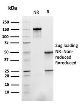 ACTN2 Antibody / Alpha Actinin 2 / Sarcomeric Alpha Actinin