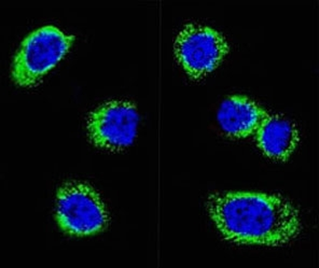 PD-L2 Antibody / Programmed death ligand 2 / CD273