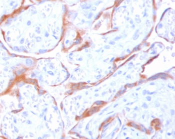 PAPPA Antibody / Pappalysin-1