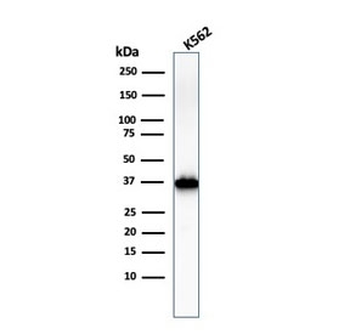 Nucleophosmin Antibody / NPM1