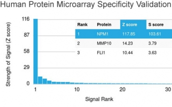 Nucleophosmin Antibody / NPM1