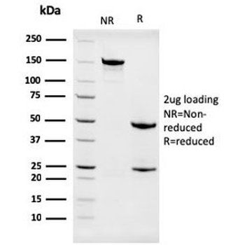 Nucleophosmin Antibody / NPM1