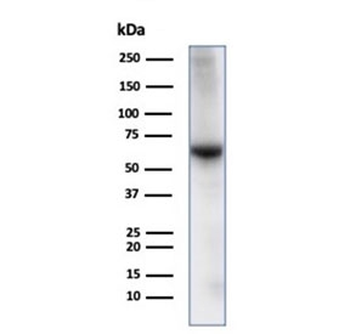 Albumin Antibody / ALB
