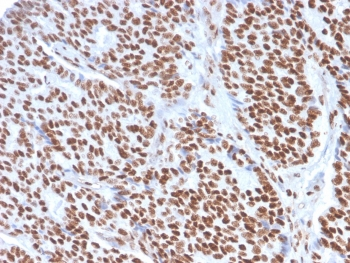 Estrogen Receptor alpha Antibody