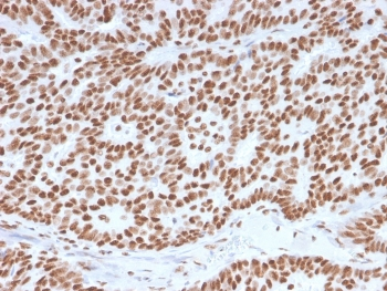 Estrogen Receptor alpha Antibody
