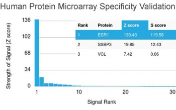 Estrogen Receptor alpha Antibody