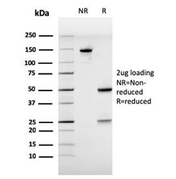 Estrogen Receptor alpha Antibody