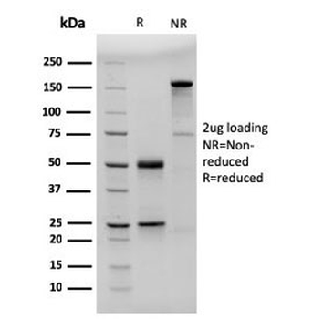 CD23 Antibody