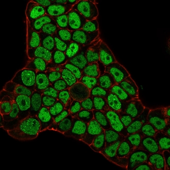 MSH6 Antibody