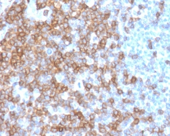 CD43 Antibody