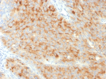Synaptophysin Antibody