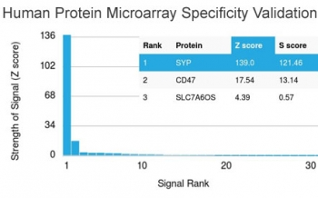 Synaptophysin Antibody