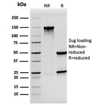 Synaptophysin Antibody