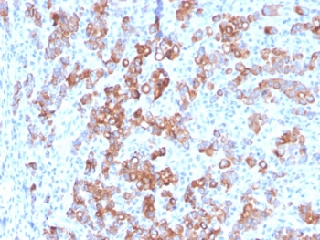 TIM-3 Antibody / HAVCR2