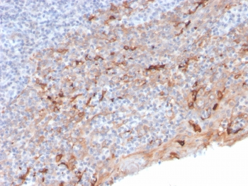 TIM-3 Antibody / HAVCR2