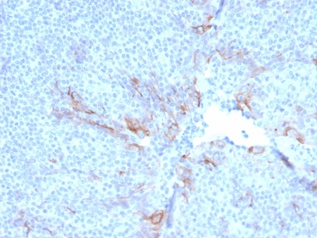 TIM-3 Antibody / HAVCR2