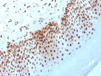 Nucleophosmin Antibody / NPM1