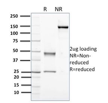 Nucleophosmin Antibody / NPM1