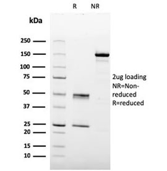 Prohibitin Antibody / PHB