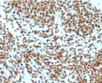 Nucleophosmin Antibody / NPM1