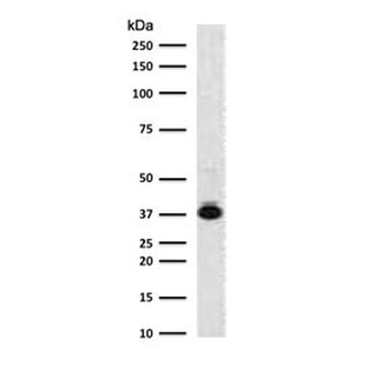 Nucleophosmin Antibody / NPM1