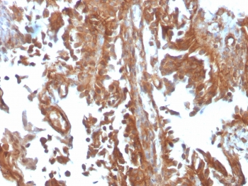 SERBP1 Antibody / PAI-RBP1