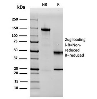 SERBP1 Antibody / PAI-RBP1