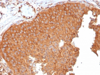 SERBP1 Antibody / PAI-RBP1