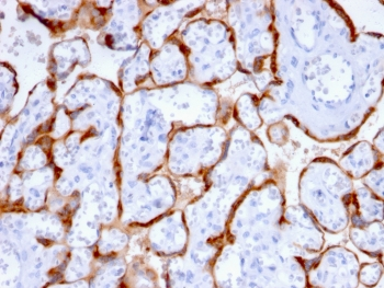 PAPP-A Antibody / Pappalysin-1