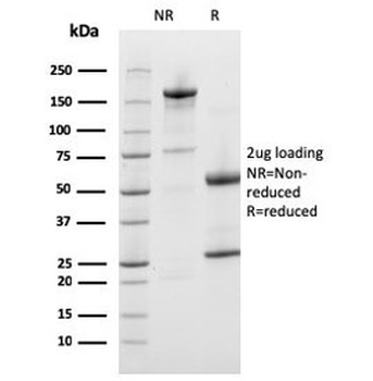 Prohibitin Antibody / PHB