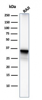 CD20 Antibody