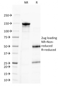 CD20 Antibody