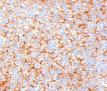 SERBP1 Antibody / PAI-RBP1