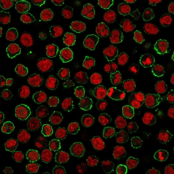 CD20 Antibody