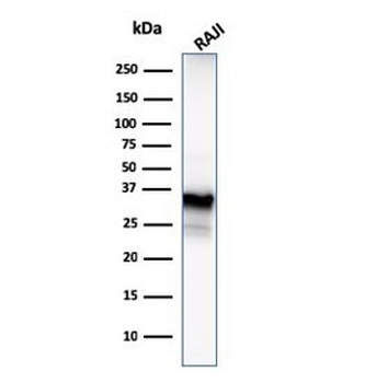 CD20 Antibody