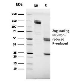 CD20 Antibody