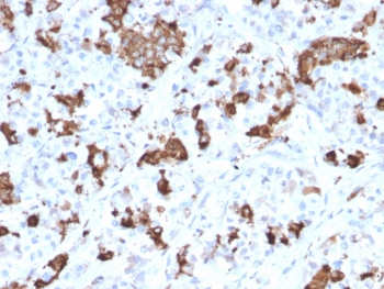 Prolactin Antibody / PRL