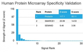 Prolactin Antibody / PRL
