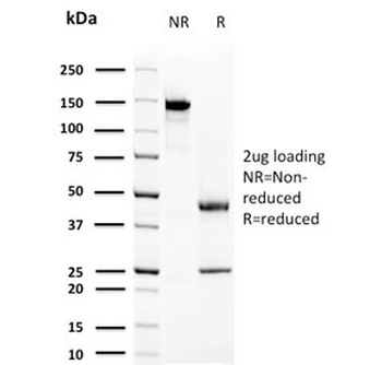 Prolactin Antibody / PRL