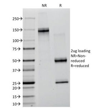 Lambda Light Chain Antibody / Lambda Antibody
