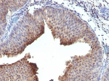 Cytokeratin 6 Antibody