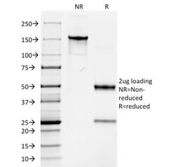 Basic Cytokeratin Antibody (HMW / Type II)
