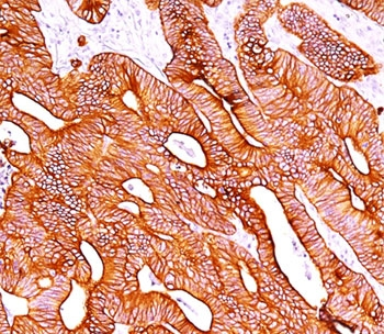 Pan Cytokeratin Antibody Cocktail (Acidic + Basic)
