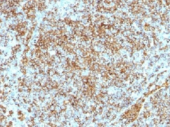 CD45RB Antibody (B-cell marker)