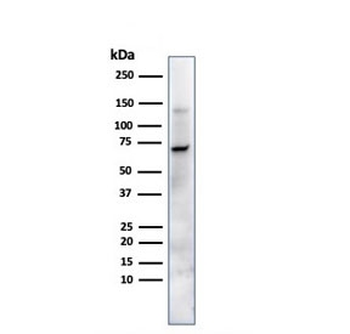 Placental Alkaline Phosphatase Antibody / ALPP